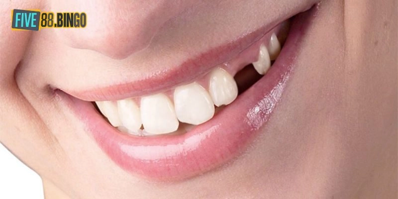 Five88 | Giải Mã Nằm Mơ Rụng Răng Đánh Con Gì Dễ Trúng?